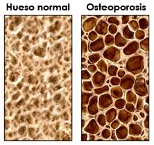 menopausia 03